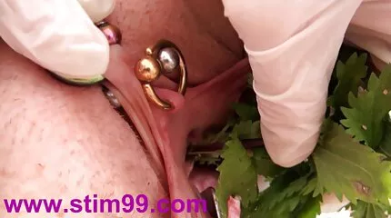 Hitne ព្រះគុណព្រះគុណព្រះគុណប្រគល់សម្រាប់ការប្រោសលោះរន្ធគូថ។